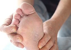 Online Athlete's Foot Treatment