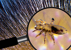 Picture of body lice