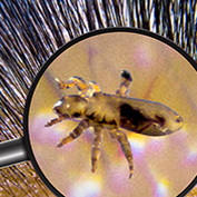 picture of body lice