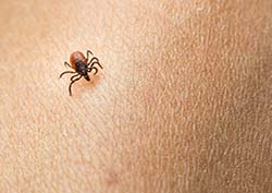 Online Lyme Disease Treatment | Online Doxycycline